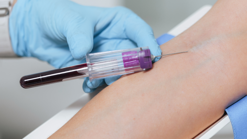Healthcare worker performs blood draw from patient arm vein in modern medical clinic.